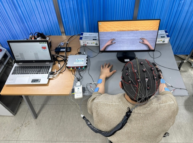 Efficacy of brain-computer interface training with motor imagery-contingent feedback in improving upper limb function and neuroplasticity among persons with chronic stroke: a double-blinded, parallel-group, randomized controlled trial.