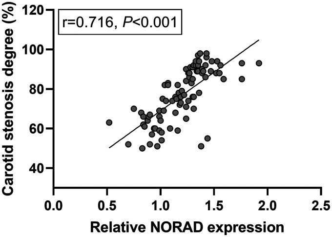 Prospective Study of lncRNA NORAD for Predicting Cerebrovascular Events in Asymptomatic Patients with Carotid Artery Stenosis.