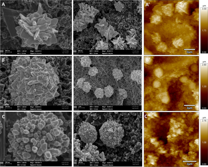 Electrochemical aptasensor for the selective detection of vancomycin based on nanostructured “in-lab” printed electrodes