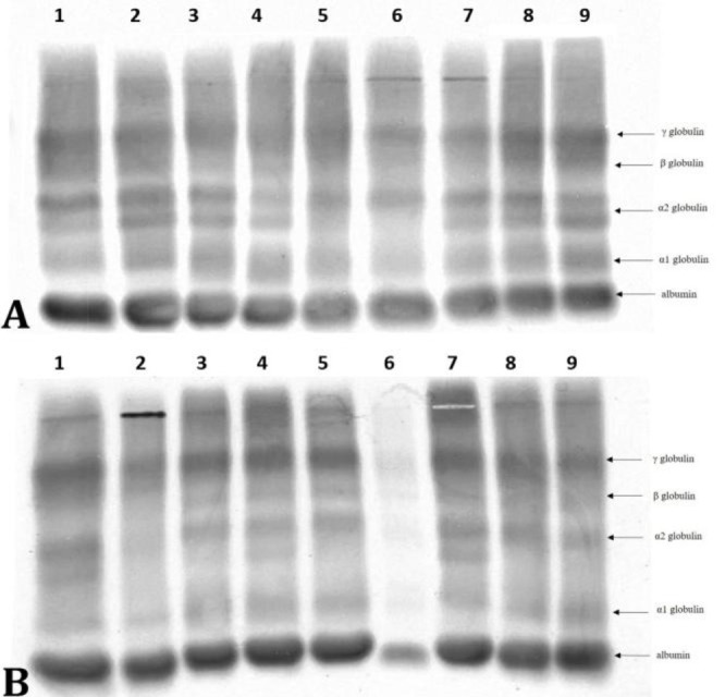 Tibial plateau levelling osteotomy: significance of matrix metalloproteinases in long-term monitoring of canine stifle stabilization after cranial cruciate ligament rupture.