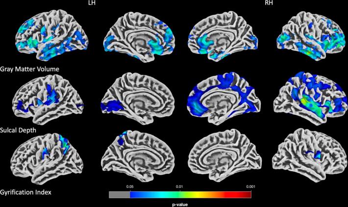 TOMM40 may mediate GFAP, neurofilament light Protein, pTau181, and brain morphometry in aging