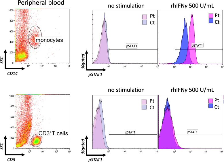 Monocyte STAT1 phosphorylation and treatment response of JAK inhibitors in chronic nonbacterial osteomyelitis.