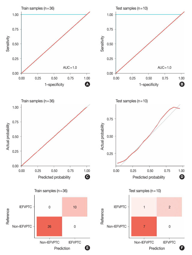Diagnosis of invasive encapsulated follicular variant papillary thyroid carcinoma by protein-based machine learning.