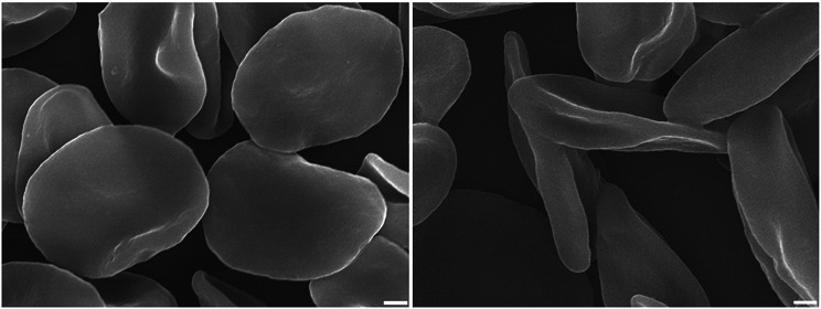 Zeatin Elicits Premature Erythrocyte Senescence Through Calcium and Oxidative Stress Mediated by the NOS/PKC/CK1α Signaling Axis.