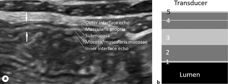 Gastrointestinal Ultrasound: Measurements and Normal Findings - What Do You Need to Know?