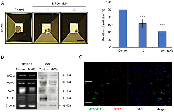 Anti‑angiogenic effect of <i>Bryopsis plumosa</i>‑derived peptide via aquaporin 3 in non‑small cell lung cancer.