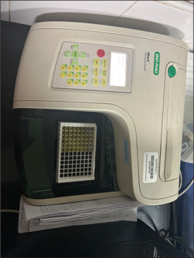 Estimation of the salivary levels of monocyte chemoattractant protein-1 and macrophage inflammatory protein-1α in periodontitis patients with and without diabetes in comparison to systemically and periodontally healthy individuals.
