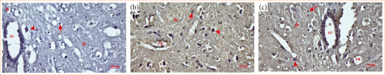 Gallic acid showed neuroprotection against endoplasmic reticulum stress in rats.