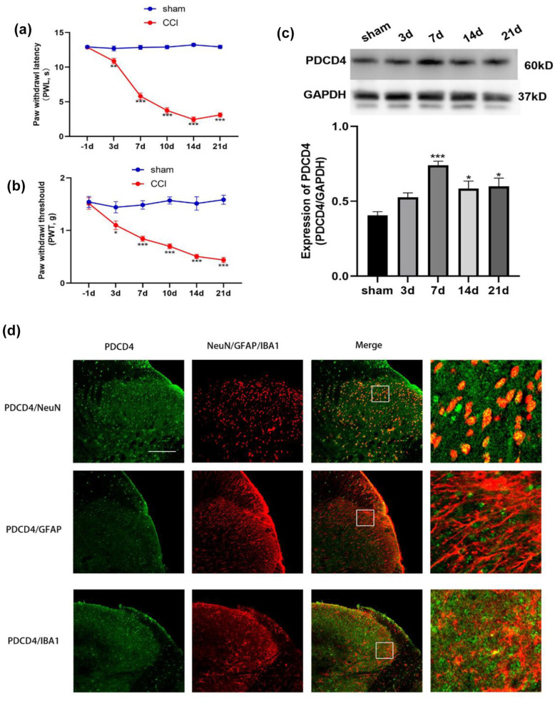 PDCD4 inhibition alleviates neuropathic pain by regulating spinal autophagy and neuroinflammation.
