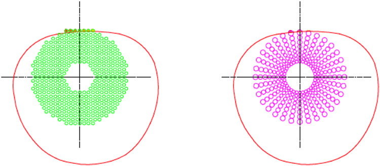 Real–world outcomes on myopia management efficacy of diverse segmented defocus optics (DSDO) and defocus incorporated multiple segments (DIMS) spectacle lenses in Chinese children: An initial 12–month prospective clinical study