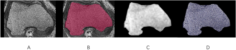 Comparison of trabecular bone microarchitecture between older males with and without a running habit: A cross-sectional study