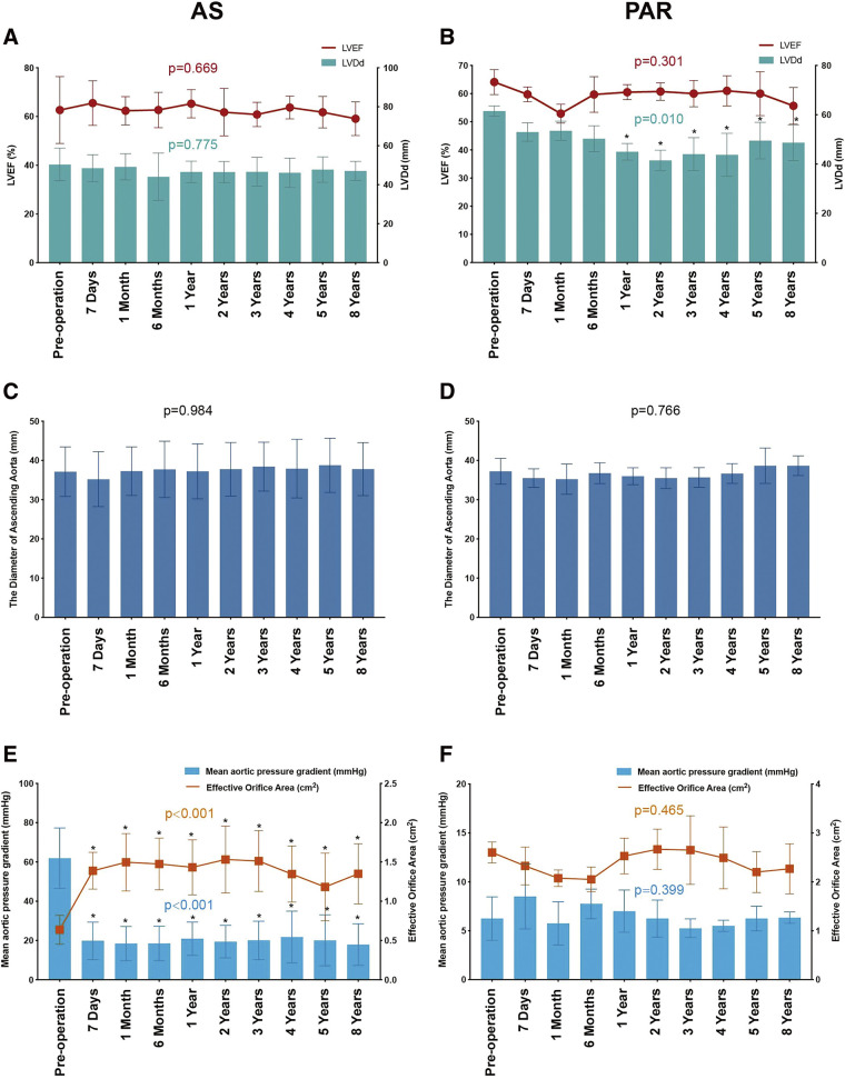 Eight-Year Clinical Outcomes of Transcatheter Aortic Valve Replacement with J-Valve System.