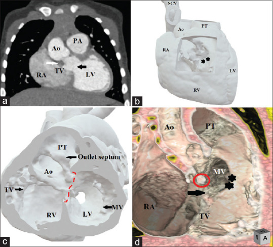Unlocking a New Dimension in the Management of Patients with Congenitally Malformed Hearts.