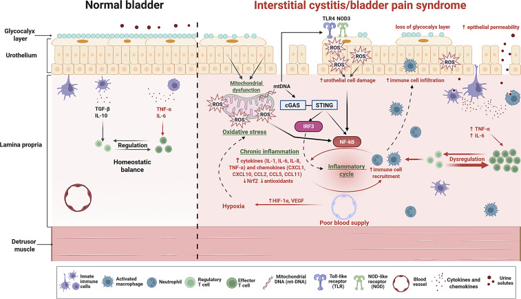 Oxidative Stress and Chronic Inflammation as Partners in Crime in Interstitial Cystitis/Bladder Pain Syndrome.