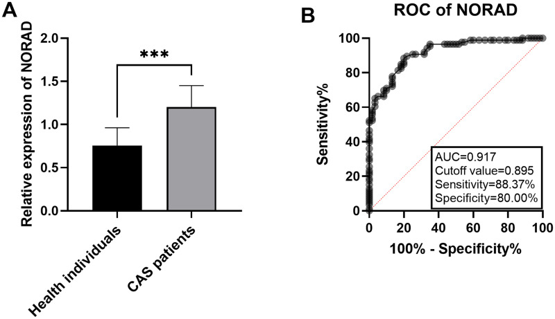 Prospective Study of lncRNA NORAD for Predicting Cerebrovascular Events in Asymptomatic Patients with Carotid Artery Stenosis.