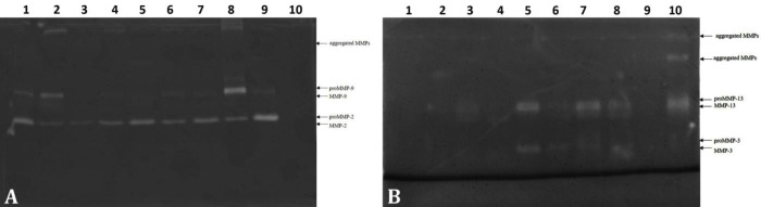 Tibial plateau levelling osteotomy: significance of matrix metalloproteinases in long-term monitoring of canine stifle stabilization after cranial cruciate ligament rupture.