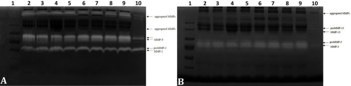 Tibial plateau levelling osteotomy: significance of matrix metalloproteinases in long-term monitoring of canine stifle stabilization after cranial cruciate ligament rupture.