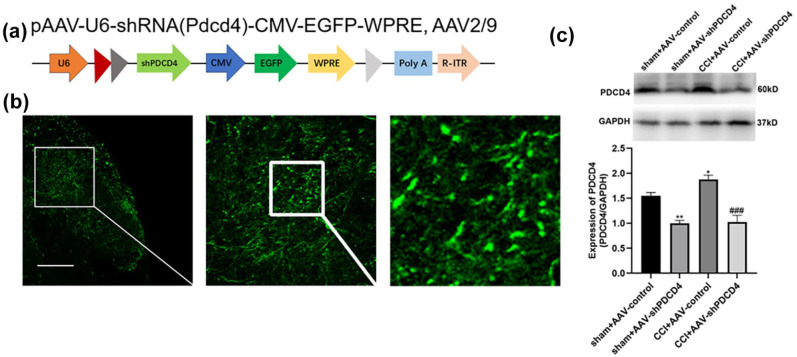 PDCD4 inhibition alleviates neuropathic pain by regulating spinal autophagy and neuroinflammation.
