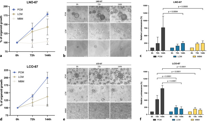 Selection of the Most Suitable Culture Medium for Patient-Derived Lung Cancer Organoids.