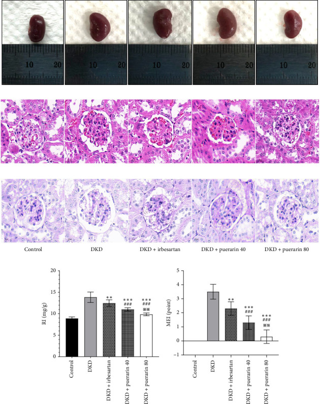 Puerarin Attenuates Podocyte Damage in Mice With Diabetic Kidney Disease by Modulating the AMPK/Nrf2 Pathway.