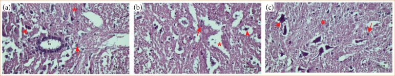 Gallic acid showed neuroprotection against endoplasmic reticulum stress in rats.
