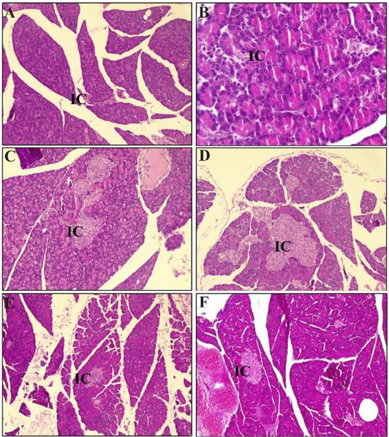 Antidiabetic Activity of <i>Momordica charantia</i> Extracts Through Incretin Pathway in Streptozotocin-Nicotinamide Induced Diabetic Rat Depends on Dose Differences.