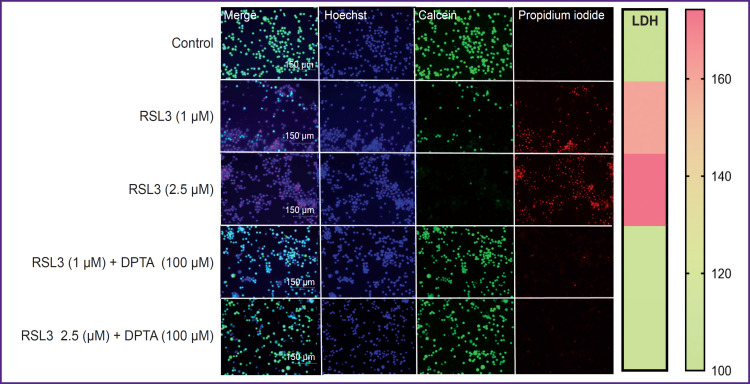 Regulation of Ferroptosis in Human Macrophage by Nitric Oxide Donors.