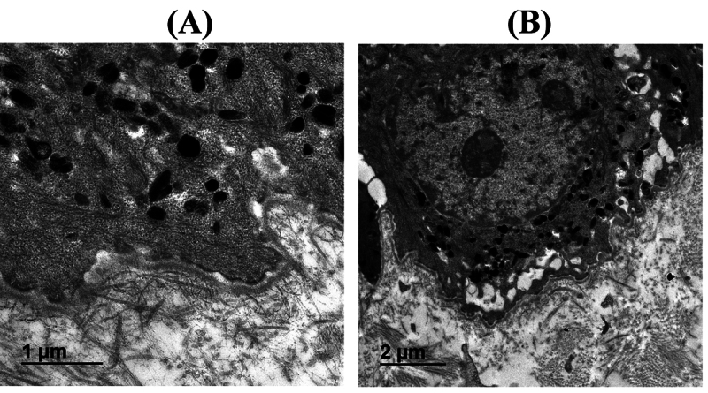 Truncated SPAG9 as a novel candidate gene for a new syndrome: Coarse facial features, albinism, cataract and developmental delay (CACD syndrome).