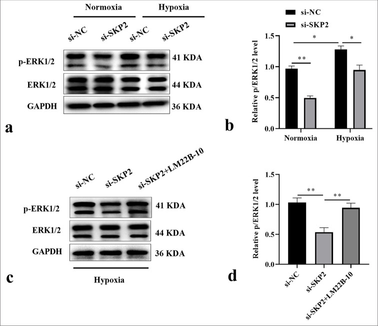 Hypoxia-induced S-phase kinase-interacting protein 2 knockdown repressed the progression of melanoma through extracellular signal-regulated kinase 1/2 pathway.