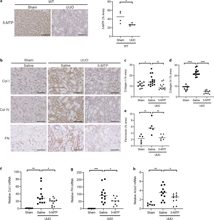 5-Methoxytryptophan Protects against Toll-Like Receptor 2-Mediated Renal Tissue Inflammation and Fibrosis in a Murine Unilateral Ureteral Obstruction Model.