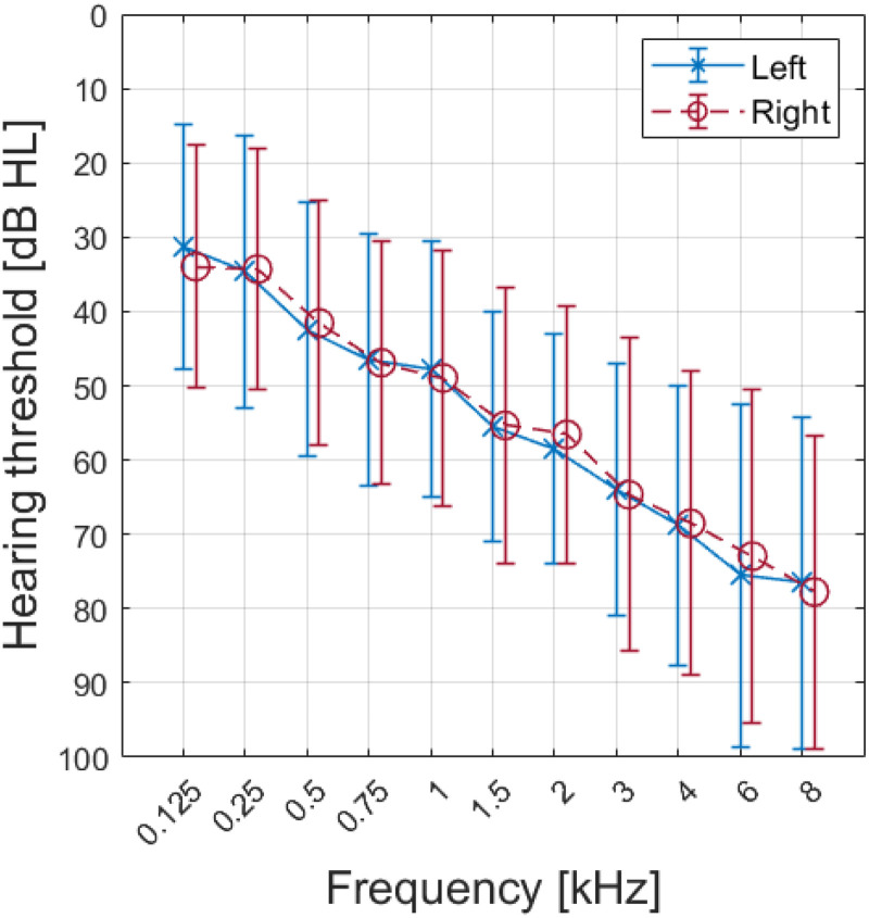 Influence of Noise Reduction on Ocular Markers of Listening Effort in Hearing Aid Users in Darkness and Ambient Light.