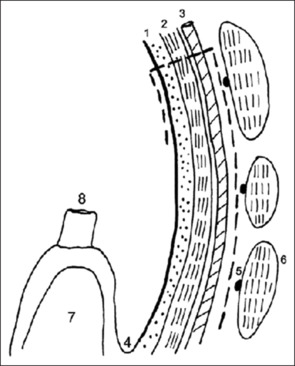 The outcomes of Facial Artery Musculomucosal (FAMM) flaps in oral oncologic reconstructions.