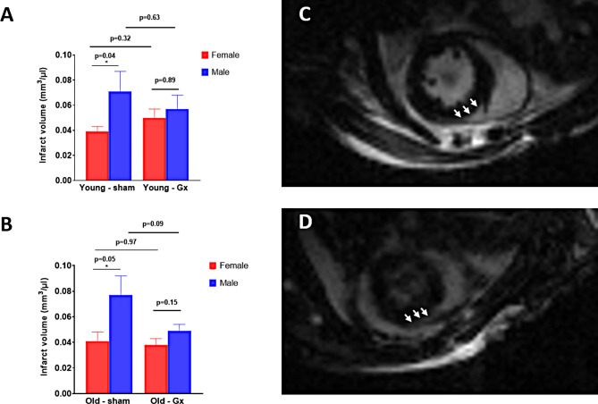 Age- and sex-specific differences in myocardial sympathetic tone and left ventricular remodeling following myocardial injury.
