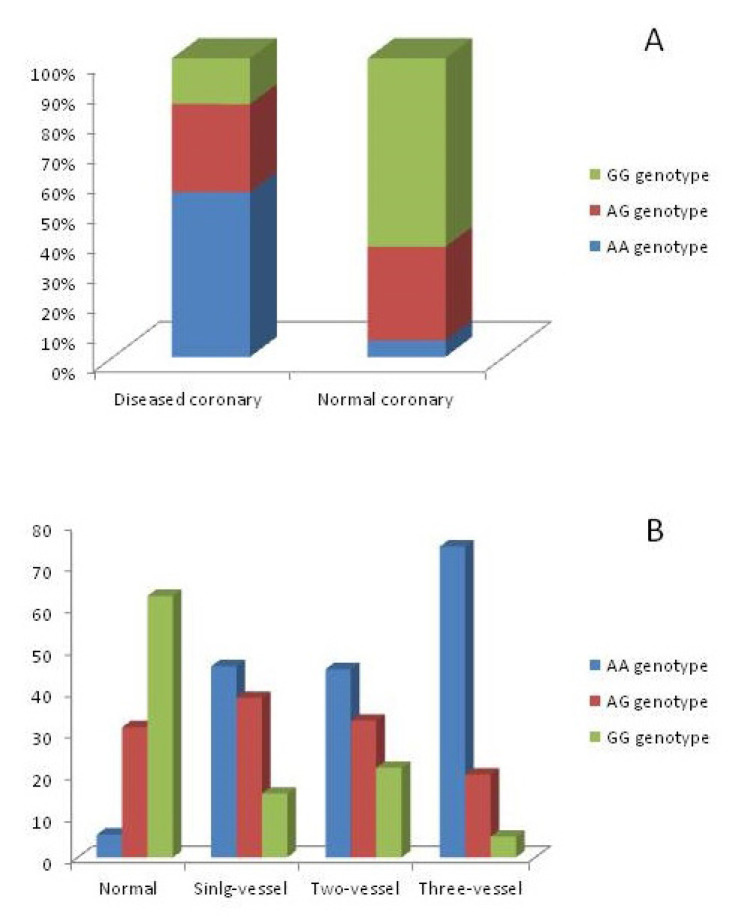 rs17576 polymorphism of matrix metalloproteinase-9 in predicting coronary artery disease severity and its adverse outcome.