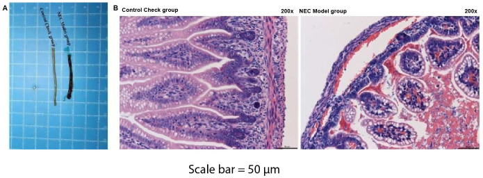 Integrated Analysis of Gut Microbiota and Metabolites in a Rat Necrotizing Enterocolitis Model.