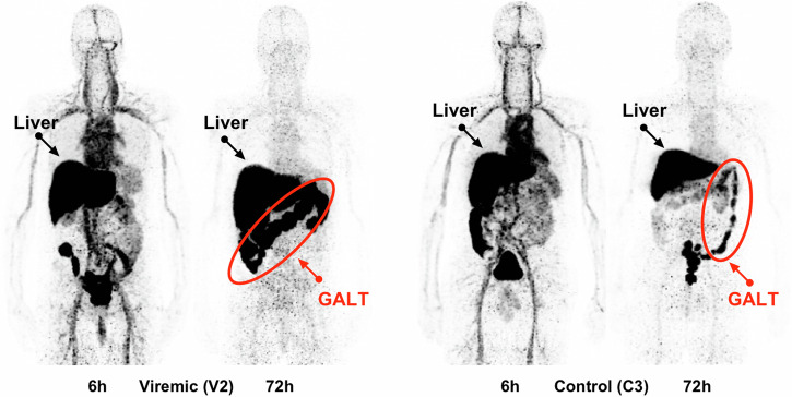Molecular imaging of viral pathogenesis and opportunities for the future.