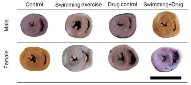 Effects of erythropoietin on cardiac morphometry in exercised male and female adolescent rats.