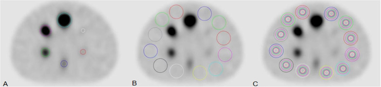 The SwiftScan step-and-shoot continuous mode improves SPECT scanning efficiency: a preliminary phantom and clinical test.