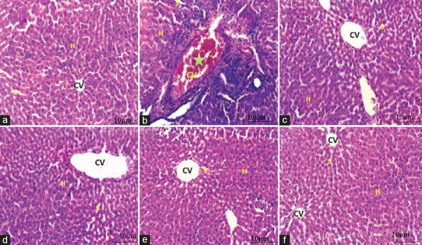 Protective effect of hesperidin, ascorbic acid and their combination on oxidative stress, dyslipidemia, and histological changes in antitubercular drug-induced hepatotoxicity in rats.