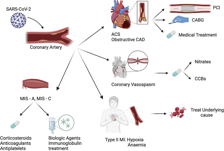 Coronary Implications of COVID-19.