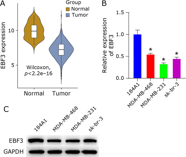 MiR-301b-3p targets and regulates EBF3 to impact the stem-like phenotype of breast cancer cells through glycolysis.