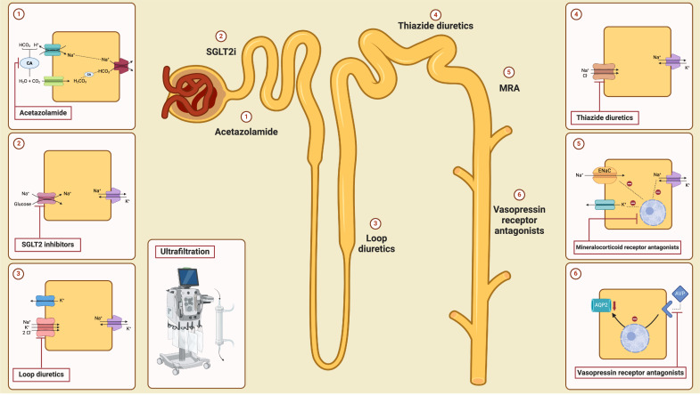 Systematic Review on the Management of Diuretic Resistance in Acute Heart Failure across the Spectrum of Kidney Disease.