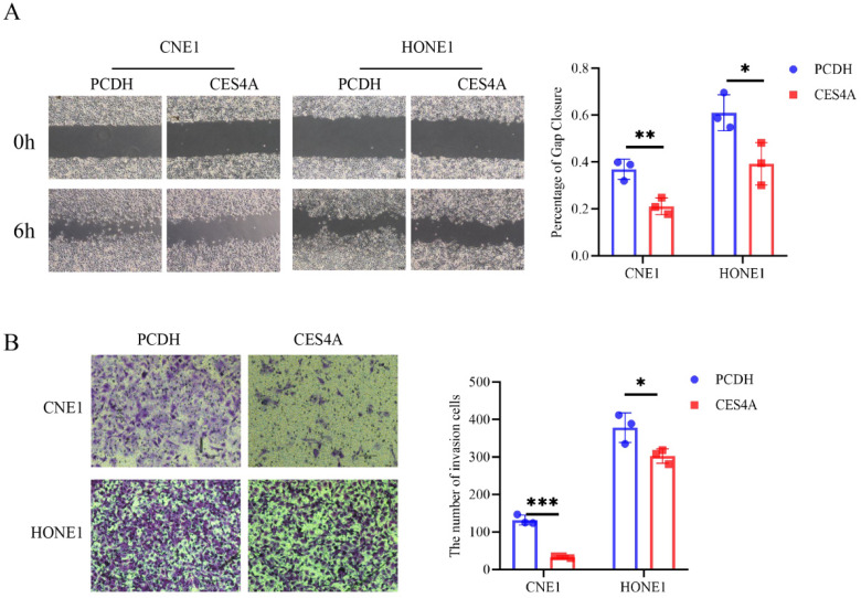 Carboxylesterase 4A Inhibits the Malignant Biological Behavior of Nasopharyngeal Carcinoma via the PI3K/AKT Pathway.
