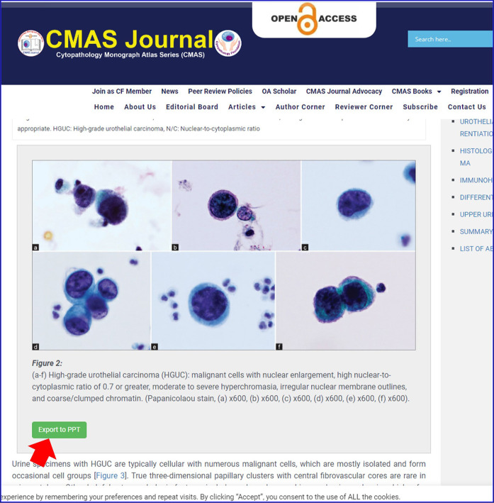 Fourth Cytopathology Monograph and Atlas Series Book Titled "Cytopathology of Urine (& The Paris System)" as Extension of Open Access Charter of Cytopathology Foundation Inc.