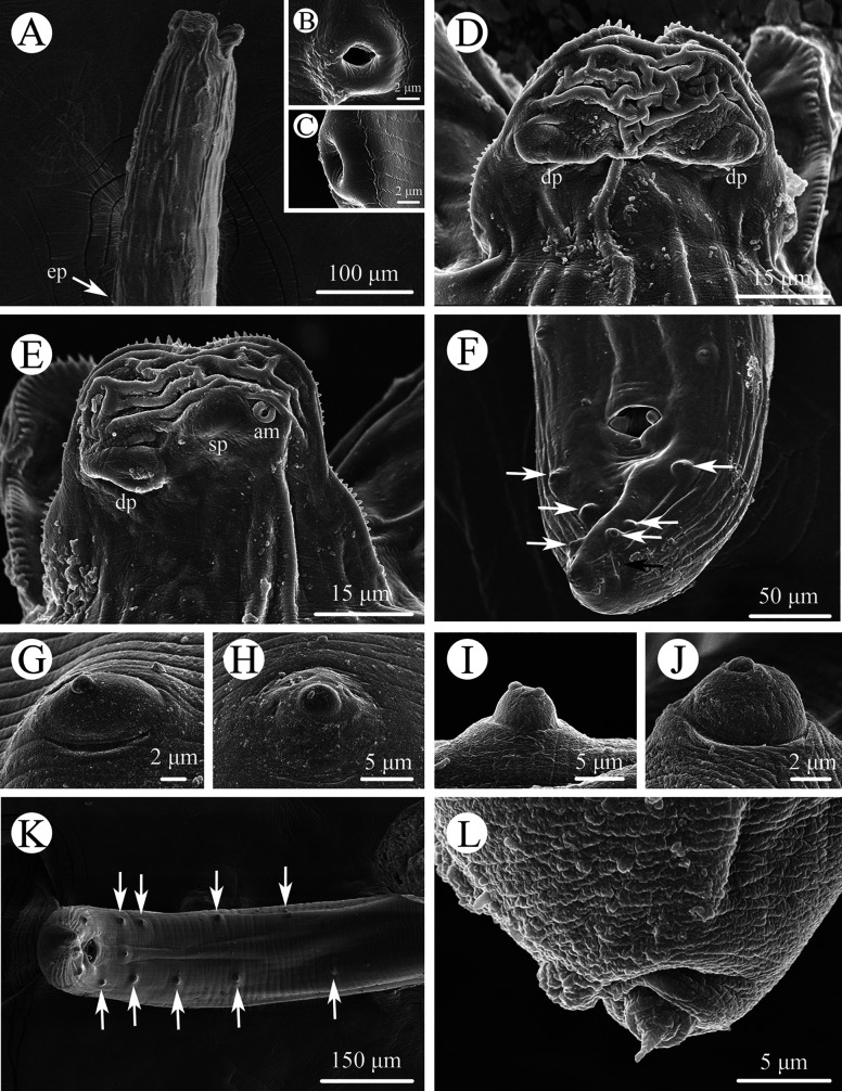 Integrated evidence reveals a new subspecies of the genus Seuratascaris (Nematoda: Ascaridomorpha), with characterization of the complete mitochondrial genome.