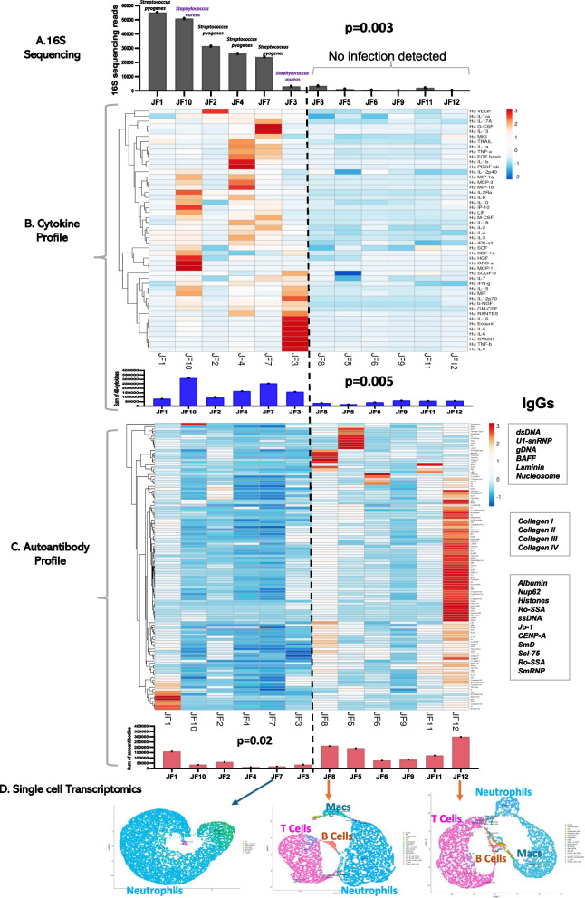Joint fluid multi-omics improves diagnostic confidence during evaluation of children with presumed septic arthritis.
