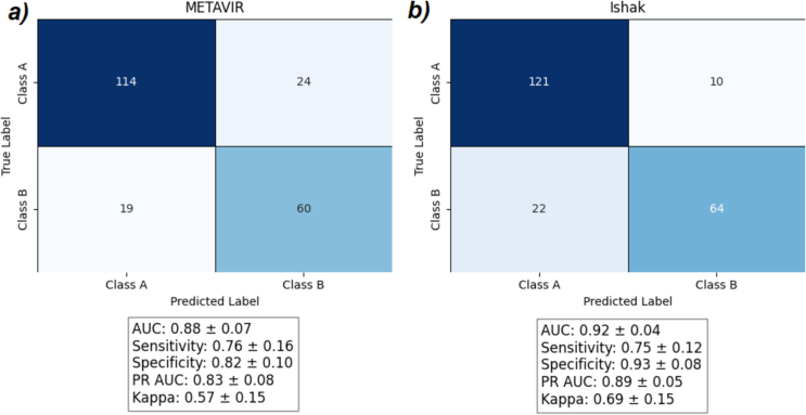 Liver fibrosis classification on trichrome histology slides using weakly supervised learning in children and young adults