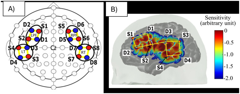 Measuring Speech Discrimination Ability in Sleeping Infants Using fNIRS-A Proof of Principle.