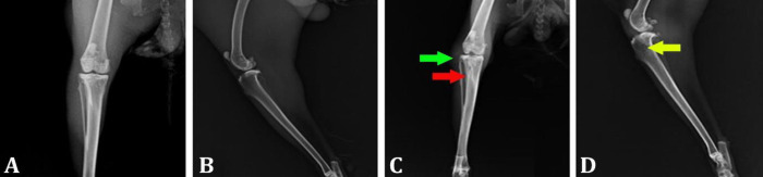 Evaluation of effects of vancomycin/polycaprolactone nanocomposite in comparison with curcumin/polycaprolactone on the healing of experimental osteomyelitis in rabbit tibia.