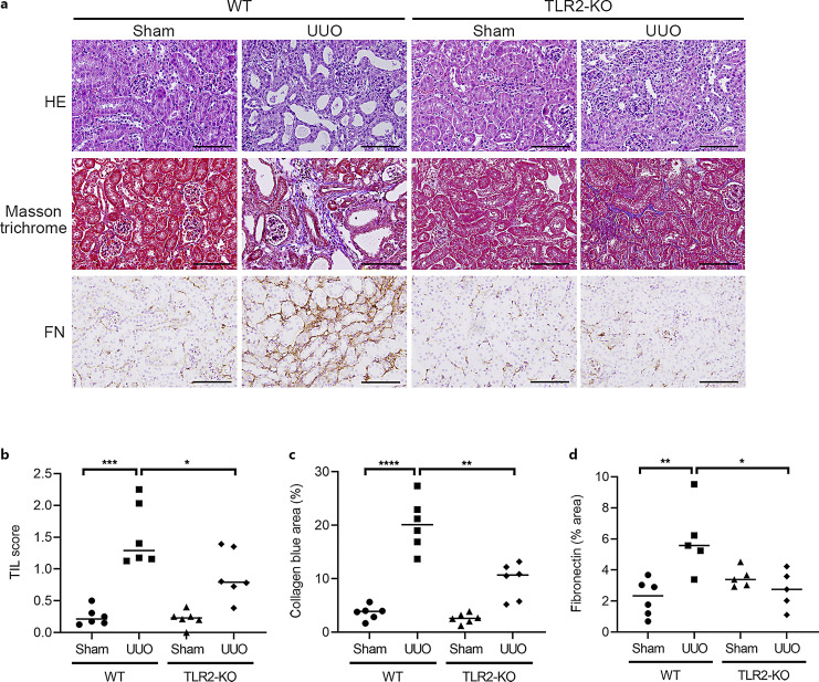 5-Methoxytryptophan Protects against Toll-Like Receptor 2-Mediated Renal Tissue Inflammation and Fibrosis in a Murine Unilateral Ureteral Obstruction Model.